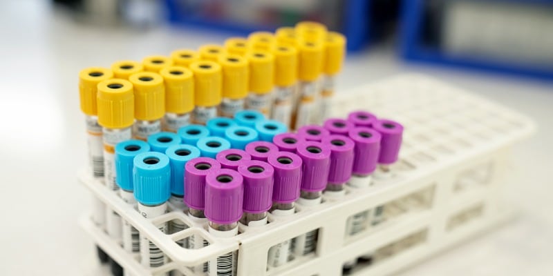 Sample test tubes - A Complete Guide to Vacutainer® Tubes